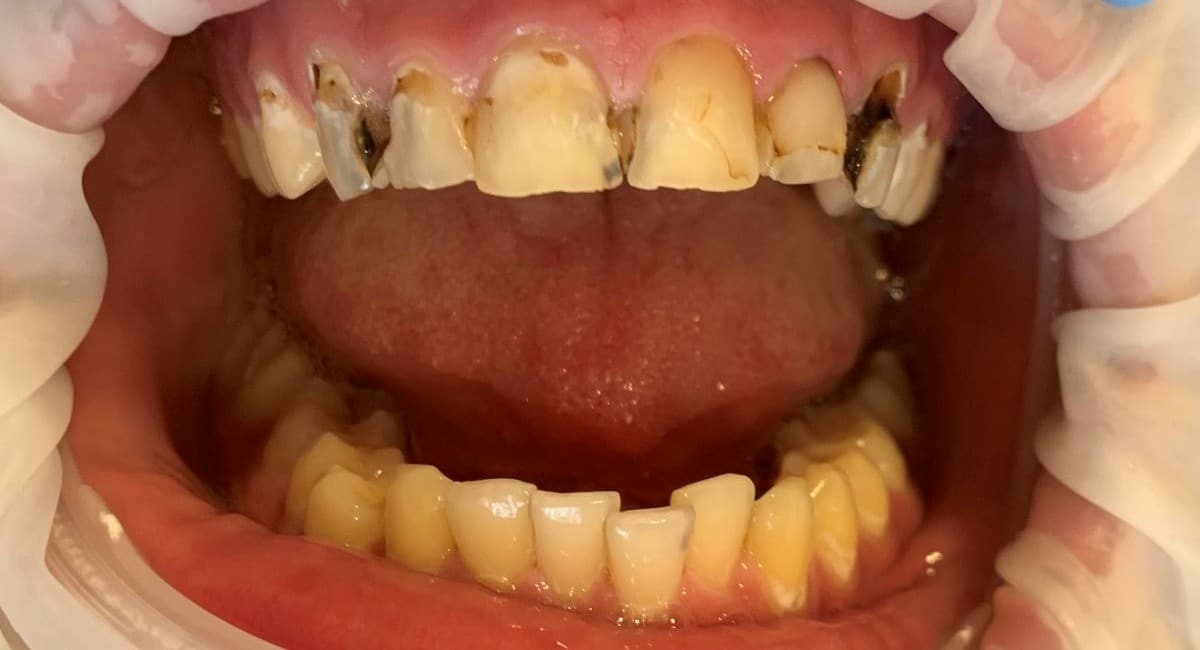 SOS_tömések_előtte_kép SOS_tömések_előtte_kép